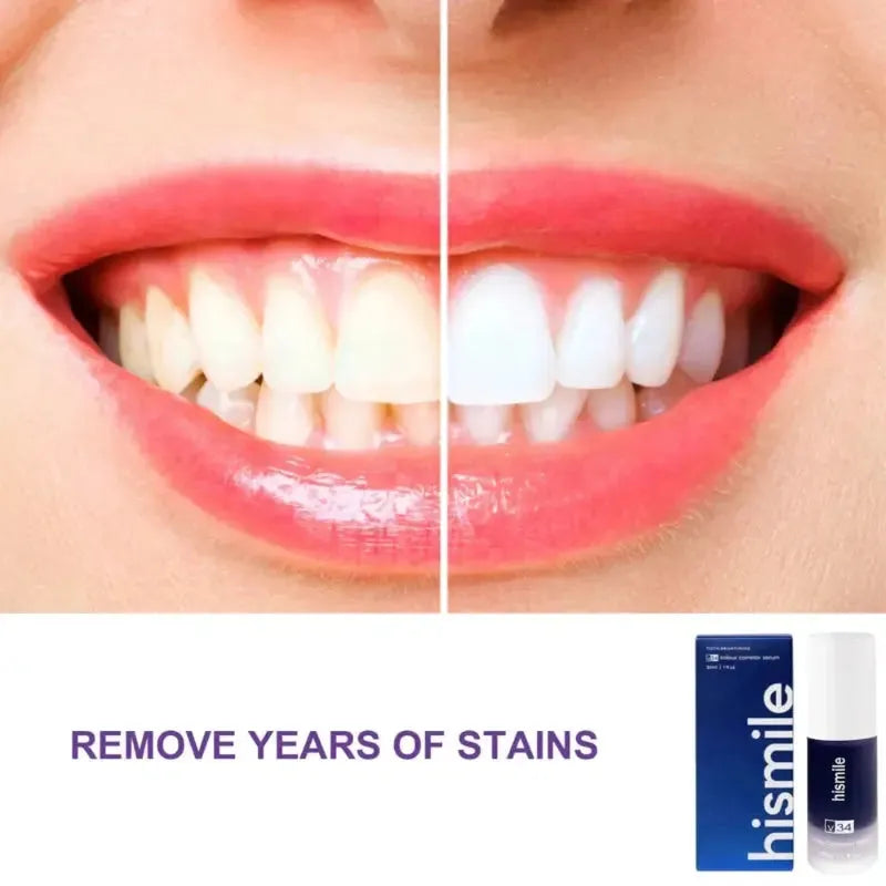 Hi Smile V34 Teeth Whitening Serum - khubsurti Hi Smile V34 Teeth Whitening Serum wddtrn-rx.myshopify.com